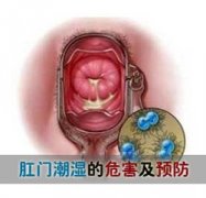 ���ų�ʪ��Σ������Щ��