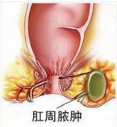 ����ŧ�׵�ֻ��ҩ�����ƺ���